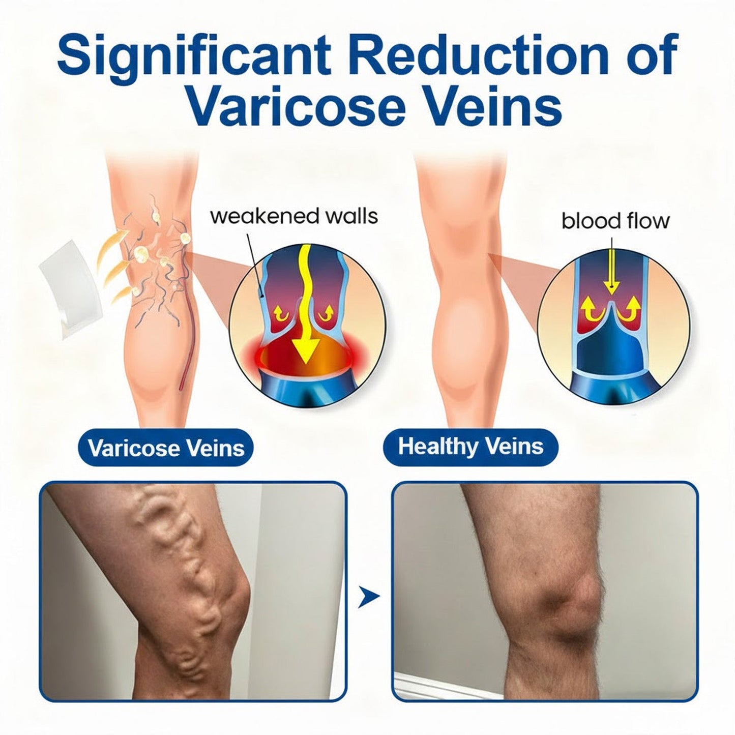 IE👨‍⚕️✅ Natravor® VeinEase Microneedle Care Patch ⚡ Fast Comfort, Lasting Leg Support