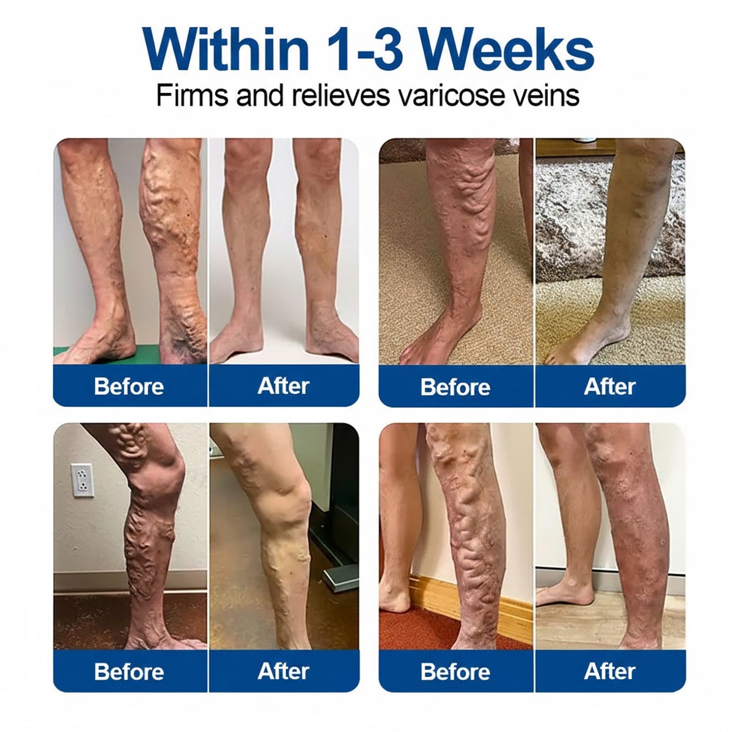 IE👨‍⚕️✅ Natravor® VeinEase Microneedle Care Patch ⚡ Fast Comfort, Lasting Leg Support